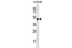 Western Blotting (WB) image for anti-Homeobox D10 (HOXD10) antibody (ABIN2996848) (HOXD10 抗体)