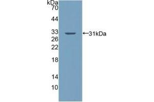 Detection of Recombinant PALLD, Human using Polyclonal Antibody to Palladin (PALLD) (PALLD 抗体  (AA 1137-1383))
