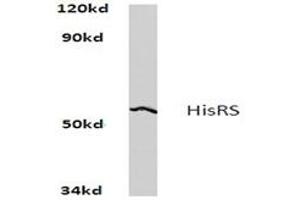 Image no. 1 for anti-Histidyl-tRNA Synthetase (HARS1) antibody (ABIN272164) (HARS1/Jo-1 抗体)