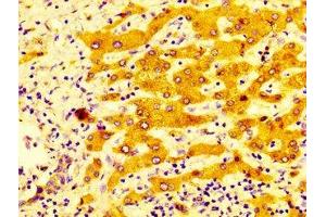 Immunohistochemistry (IHC) image for anti-Cytochrome P450, Family 2, Subfamily C, Polypeptide 19 (CYP2C19) (AA 245-353) antibody (ABIN7149243)