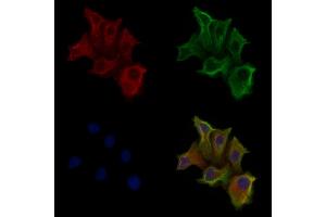 ABIN6258162 and ABIN6275961 staining Hela cells by IF/ICC. (GPR160 抗体  (C-Term))