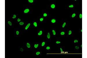 Immunofluorescence of monoclonal antibody to HMGB2 on HeLa cell. (HMGB2 抗体  (AA 1-195))