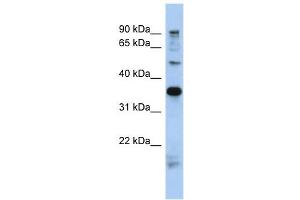 MGC70924 antibody used at 1 ug/ml to detect target protein. (PRR19 抗体  (N-Term))
