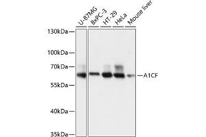 Western blot analysis of extracts of various cell lines, using CF antibody (3087) at 1:3000 dilution. (A1CF 抗体  (AA 50-120))