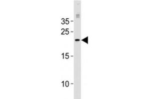 Western Blotting (WB) image for anti-O6-Methylguanine-DNA-Methyltransferase (MGMT) (AA 1-30) antibody (ABIN3032087)