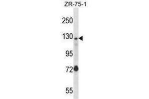 UBE4A Antibody (Center) western blot analysis in ZR-75-1 cell line lysates (35 µg/lane). (UBE4A 抗体  (Middle Region))