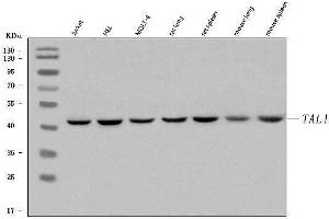 Western blot analysis of TAL1 using anti-TAL1 antibody (ABIN7602930).