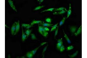 Immunofluorescence staining of Hela cells with ABIN7152118 at 1:133, counter-stained with DAPI. (GSPT1 抗体  (AA 6-142))