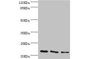 Western blot All lanes: TAGLN2 antibody at 4. (TAGLN2 抗体  (AA 1-199))
