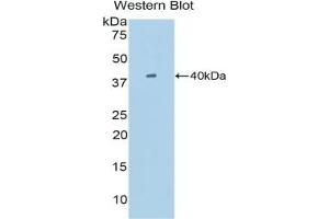 Detection of Recombinant SIGIRR, Mouse using Polyclonal Antibody to Single Ig IL1 Related Receptor (SIGIRR)