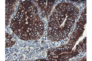 Image no. 2 for anti-Tumor Protein D52-Like 3 (TPD52L3) antibody (ABIN1501475) (TPD52L3 抗体)