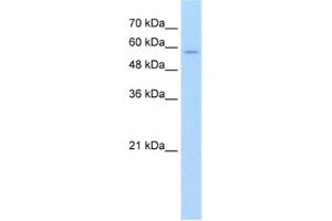 Western Blotting (WB) image for anti-Solute Carrier Family 22 (Organic Cation Transporter), Member 16 (SLC22A16) antibody (ABIN2462772)