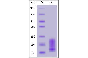 Biotinylated Human BAFFR, His,Avitag on  under reducing (R) condition. (TNFRSF13C Protein (AA 7-71) (His tag,AVI tag,Biotin))
