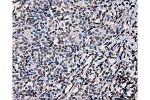 Immunohistochemical staining of paraffin-embedded liver tissue using anti-DAPK2 mouse monoclonal antibody. (DAPK2 抗体)