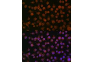 Immunofluorescence analysis of HeLa cells using Emerin/EMD Rabbit mAb (ABIN7266933) at dilution of 1:100 (40x lens). (Emerin 抗体)