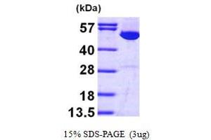 SDS-PAGE (SDS) image for Inosine 5'-Phosphate Dehydrogenase 1 (IMPDH1) (AA 1-514) protein (His tag) (ABIN667787)