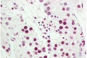Immunohistochemistry (IHC) image for anti-Nuclear Receptor Subfamily 2, Group F, Member 2 (NR2F2) (AA 1-30) antibody (ABIN1977972)