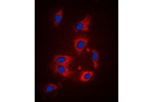 Immunofluorescent analysis of PAR1 staining in HeLa cells. (PAR1 抗体  (N-Term))