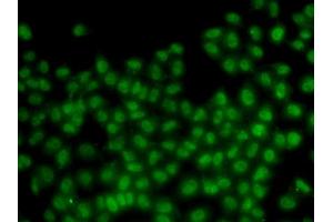 Immunofluorescence analysis of HeLa cells using ID3 antibody (ABIN6130481, ABIN6142140, ABIN6142141 and ABIN6221020).