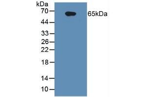 Western Blotting (WB) image for Interleukin 1 Receptor, Type I (IL1R1) ELISA Kit (ABIN6730877)