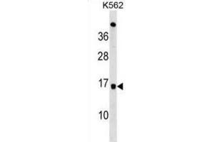 Western Blotting (WB) image for anti-Ubiquitin-Conjugating Enzyme E2D 4 (UBE2D4) antibody (ABIN3000670) (UBE2D4 抗体)