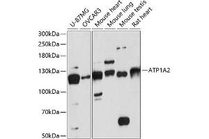 Western blot analysis of extracts of various cell lines, using  antibody (ABIN6129199, ABIN6137302, ABIN6137303 and ABIN6217930) at 1:3000 dilution. (ATP1A2 抗体  (AA 1-70))