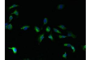 Immunofluorescent analysis of U251 cells using ABIN7165738 at dilution of 1:100 and Alexa Fluor 488-congugated AffiniPure Goat Anti-Rabbit IgG(H+L) (TMBIM1 抗体  (AA 1-109))