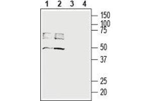 Western blot analysis of rat (lanes 1 and 3) and mouse (lanes 2 and 4) brain lysates: - 1,2. (SLC16A3 抗体  (C-Term, Intracellular))