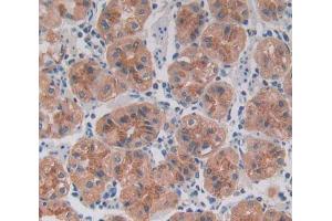 Used in DAB staining on fromalin fixed paraffin- embedded Kidney tissue (ROR2 抗体  (AA 683-934))