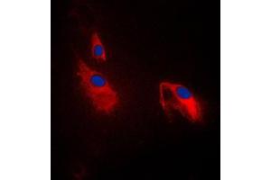 Immunofluorescent analysis of PFKP staining in NIH3T3 cells. (PFKP 抗体  (Center))