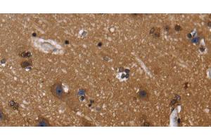 Immunohistochemistry of paraffin-embedded Human brain using FGFR1OP Polyclonal Antibody at dilution of 1:40 (FGFR1OP 抗体)