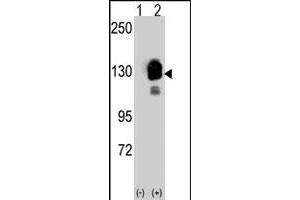 Western blot analysis of CDH8 (arrow) using rabbit CDH8 polyclonal antibody . (Cadherin 8 抗体  (N-Term))