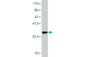 Western Blot detection against Immunogen (36. (RICTOR 抗体  (AA 1-98))