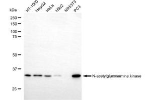 anti-N-Acetylglucosamine Kinase (NAGK) antibody