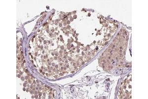 ABIN6266520 at 1/200 staining human testis tissue sections by IHC-P. (Cullin 1 抗体)