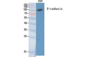 Western Blotting (WB) image for anti-Cadherin 1, Type 1, E-Cadherin (Epithelial) (CDH1) (C-Term) antibody (ABIN3184389) (E-cadherin 抗体  (C-Term))