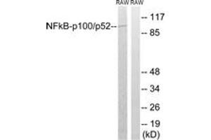 Western blot analysis of extracts from RAW264. (NFKB2 抗体  (AA 836-885))