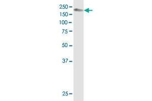 Western Blotting (WB) image for anti-Lysine (K)-Specific Demethylase 5B (KDM5B) (AA 231-319) antibody (ABIN1327126)