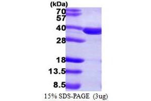 SDS-PAGE (SDS) image for Sulfotransferase Family, Cytosolic, 2A, Dehydroepiandrosterone (DHEA)-Preferring, Member 1 (SULT2A1) (AA 1-285) protein (His tag) (ABIN667467)