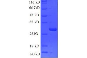 SDS-PAGE (SDS) image for Nidogen 1 (NID1) (AA 428-665) protein (His tag) (ABIN5710011)