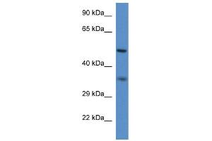 WB Suggested Anti-Pxmp3 Antibody   Titration: 1. (PEX2 抗体  (N-Term))