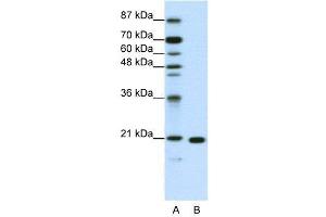 WB Suggested Anti-RPL9  Antibody Titration: 1.