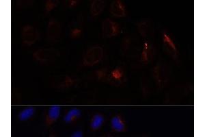 Immunofluorescence analysis of U-2 OS cells using CHP1 Polyclonal Antibody at dilution of 1:100. (CHP 抗体)