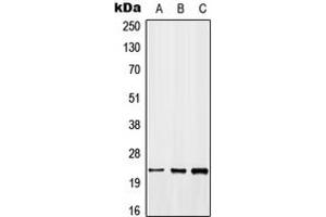 Western blot analysis of GADD45 beta expression in MCF7 (A), NIH3T3 (B), H9C2 (C) whole cell lysates. (GADD45B 抗体  (C-Term))