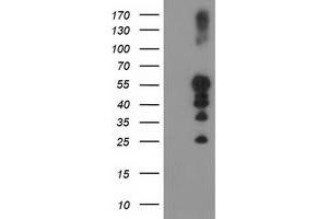 Western Blotting (WB) image for anti-Protein tyrosine Phosphatase, Non-Receptor Type 1 (PTPN1) antibody (ABIN1500495) (PTPN1 抗体)