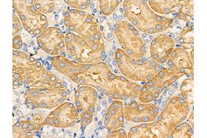 ABIN6258515 and ABIN6274734 at 1/100 staining Rat kidney tissue by IHC-P. (MRPL20 抗体  (C-Term))