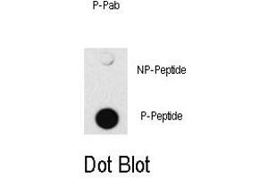 Image no. 1 for anti-SMAD Family Member 4 (SMAD4) (pThr277) antibody (ABIN358227) (SMAD4 抗体  (pThr277))