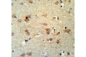 Immunohistochemistry (Paraffin-embedded Sections) (IHC (p)) image for anti-Lecithin-Cholesterol Acyltransferase (LCAT) (AA 292-321), (Middle Region) antibody (ABIN953145)