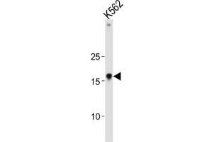 Western Blotting (WB) image for anti-High Mobility Group AT-Hook 1 (HMGA1) antibody (ABIN3004034) (HMGA1 抗体)