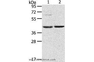 Western blot analysis of Mouse brain and liver tissue, using HIF1AN Polyclonal Antibody at dilution of 1:200 (HIF1AN 抗体)